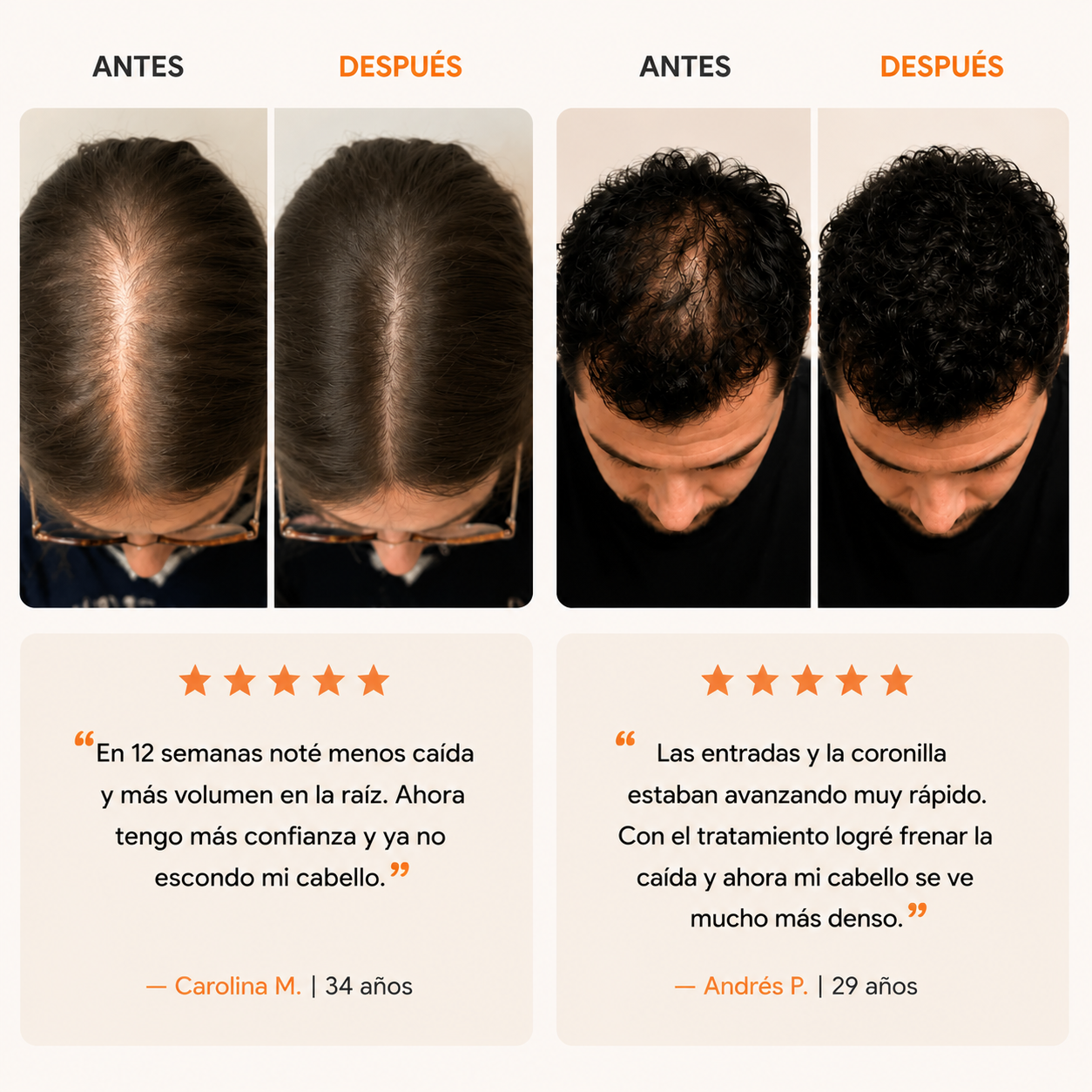 Serum Capilar | Fortalece el Cuero Cabelludo