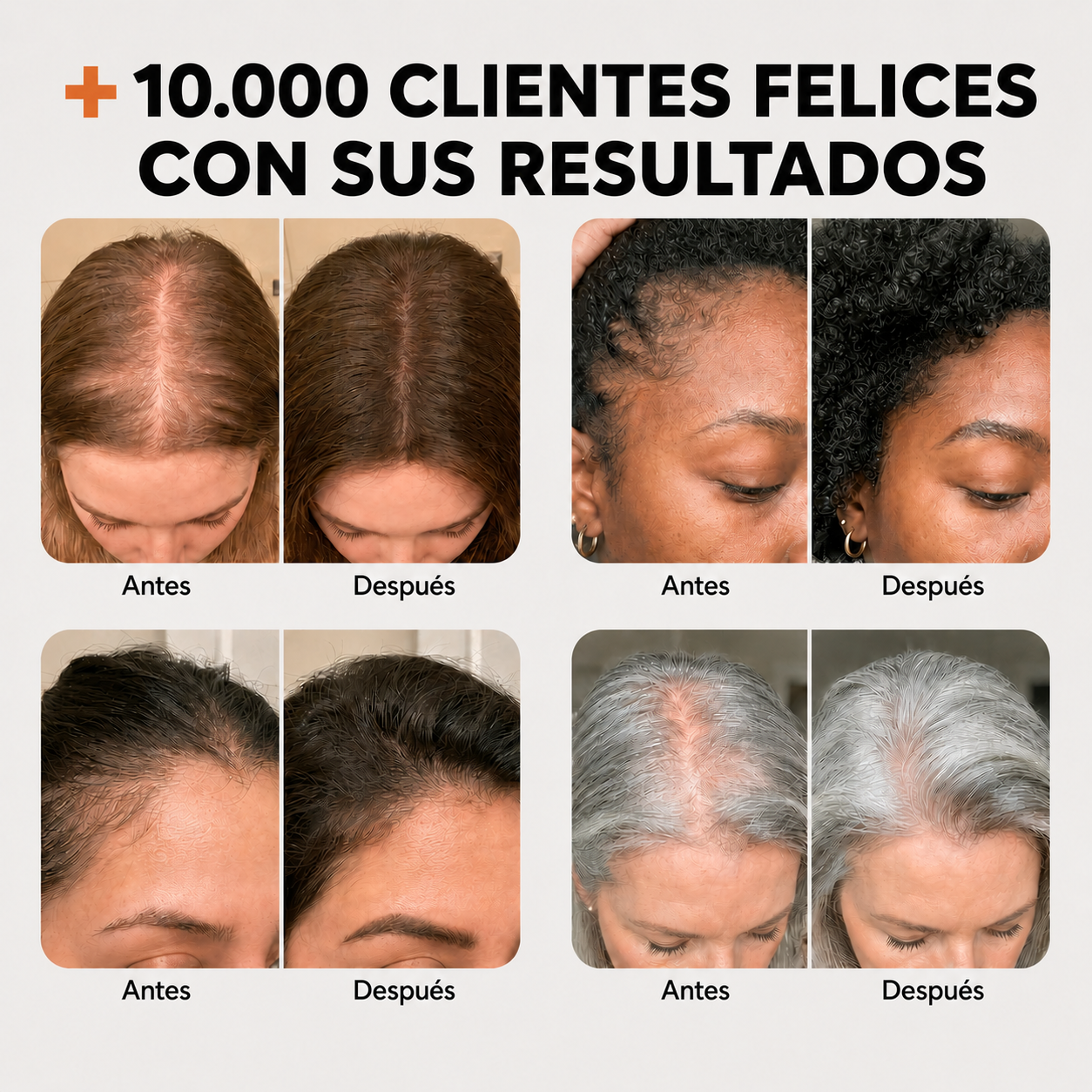 Serum Capilar | Fortalece el Cuero Cabelludo
